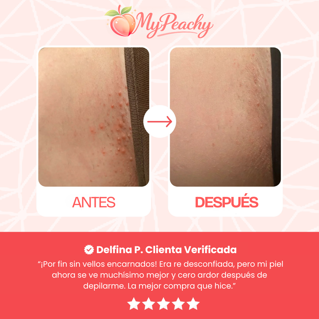 MYPEACHY® | DEPILADORA AFEITADORA ELÉCTRICA 2 EN 1: DEPILACIÓN SUAVE, SIN DOLOR NI IRRITACIÓN.